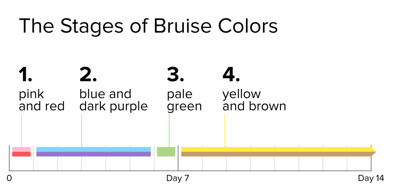 the-stages-and-colors-bruises-tellwut