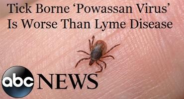 Have you (or a family member) ever been infected with the Powassan virus?