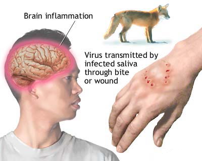 People and Rabies: It is surprising to learn that very few people die from rabies nationwide each year. Over the past 10 years, rabies has killed only a total of 28 people in the U. S. This amounts to fewer than 3 fatalities a year nationwide. People who contracted rabies in the United States were mostly infected by a bat. Most didn't even know they were bitten. Some may have been sleeping when bitten. Others handled a bat bare-handed without realizing they'd been potentially exposed to rabies. But don't panic over every bat sighting. Less than one-half of one percent of all bats in North America carries rabies. Although raccoons suffer from rabies more than any other mammal in the United States (about 35% of all animal rabies cases), only one human death from the raccoon strain of rabies has been recorded in the United States. Have you ever been bitten by a rabid animal?