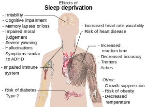 On a societal level, sleep deprivation accounts for lost productivity, medical errors, and car and industrial accidents. One study showed that medical students doing their residency, which sometimes includes as long as 30-hour shifts, are more prone to mistakes. Do you have enough time to sleep as much as you need?